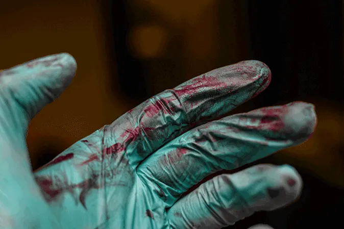 Hand wearing a surgical gloved smeared with blood
